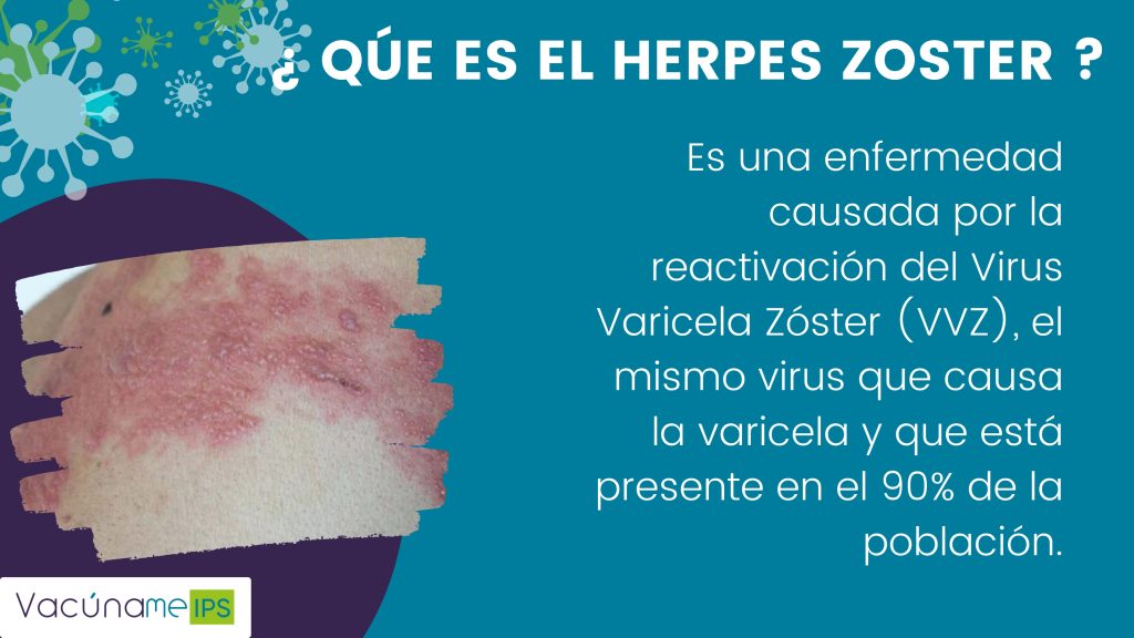 Herpes zoster (1)_page-0002