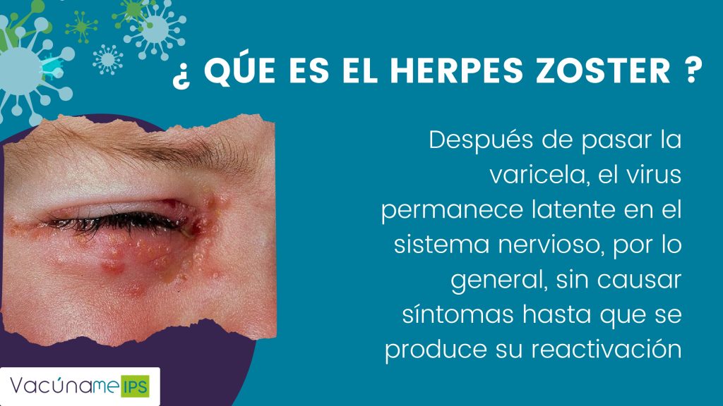 Herpes zoster (1)_page-0003